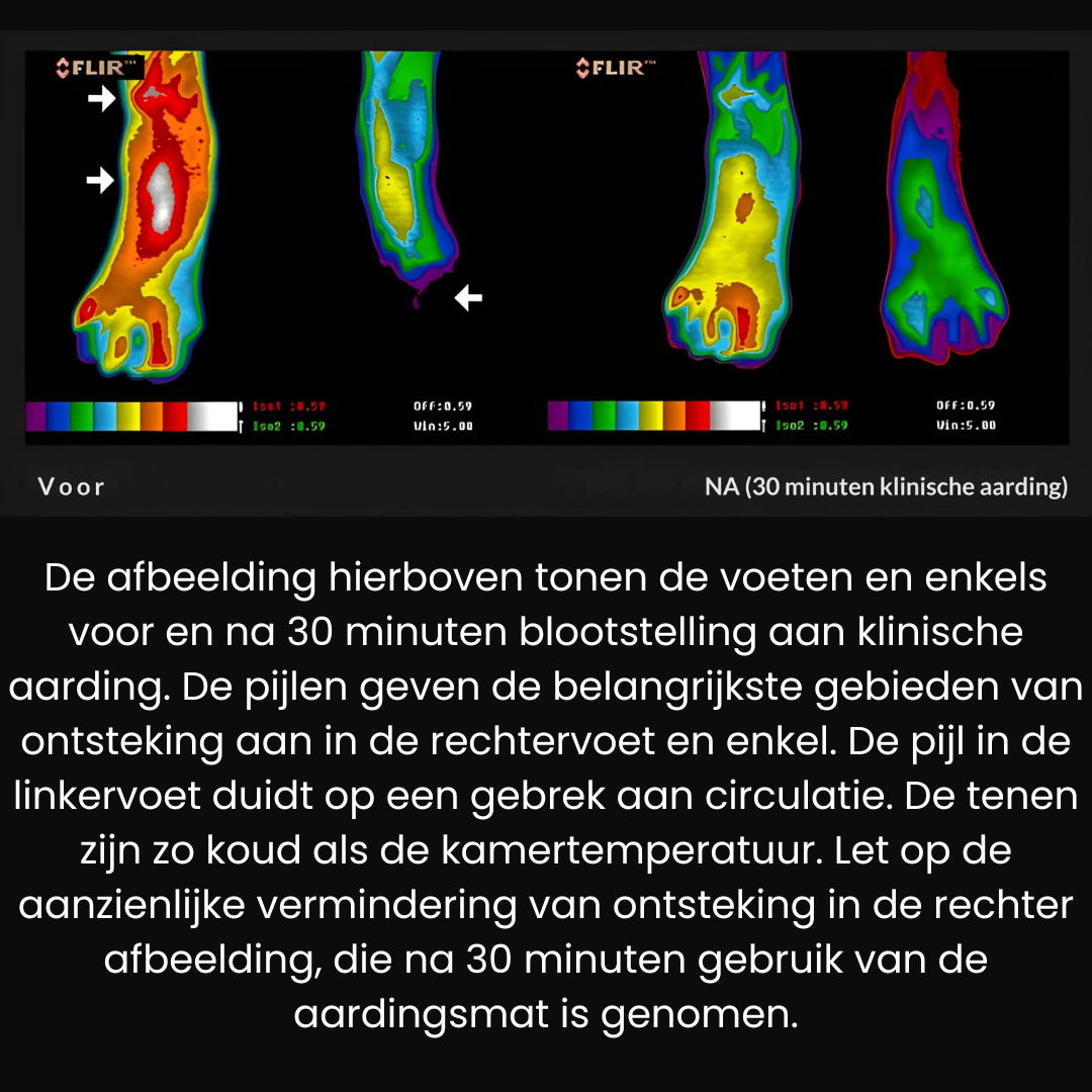 Aardingsmat